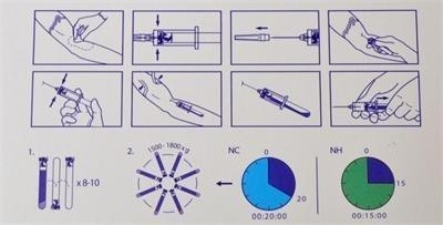 6/8x15ml 휴대용 PRP 원심장 장치 0-4000rpm